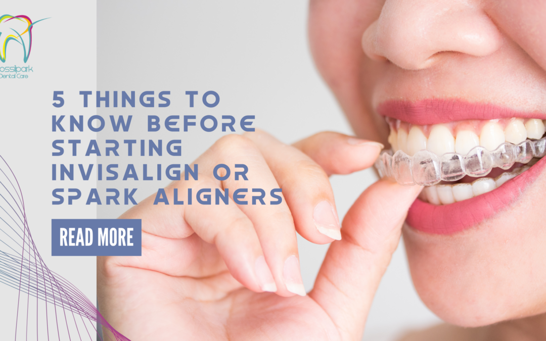 5 Things to Know Before Starting Invisalign® or Spark Aligners 